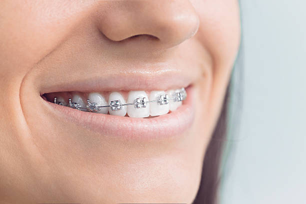 Laser Dentistry in Bradley Beach, NJ